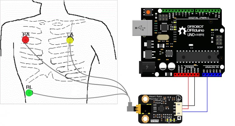 EKG Sensörü 01